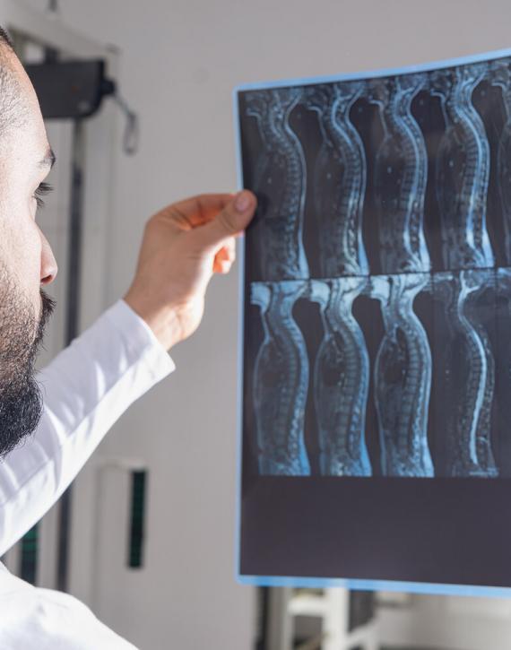 spinal-cord-injuries-accident-attorney-denver-colorado-02