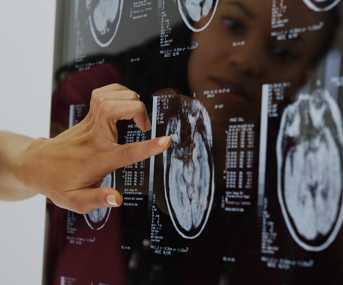 traumatic-brain-injuries-attorney-denver-colorado-02