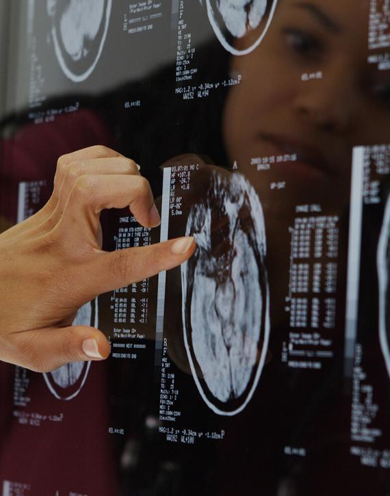 traumatic-brain-injuries-lawyer-pueblo-colorado-02