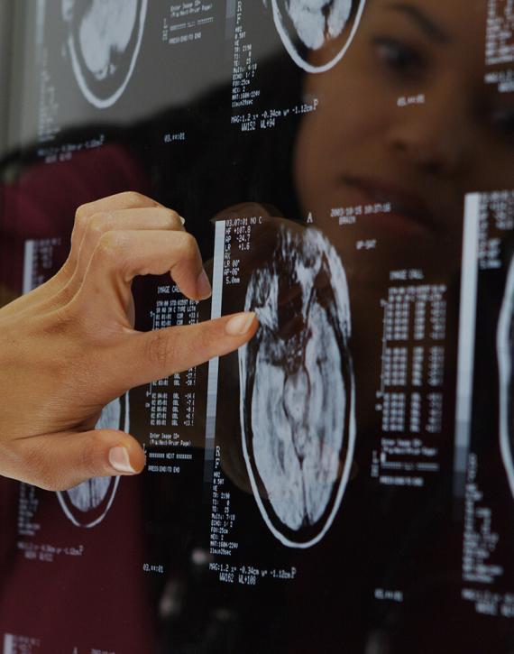 traumatic-brain-injuries-lawyer-aspen-colorado-02 traumatic-brain-injuries-lawyer-aspen-colorado-02